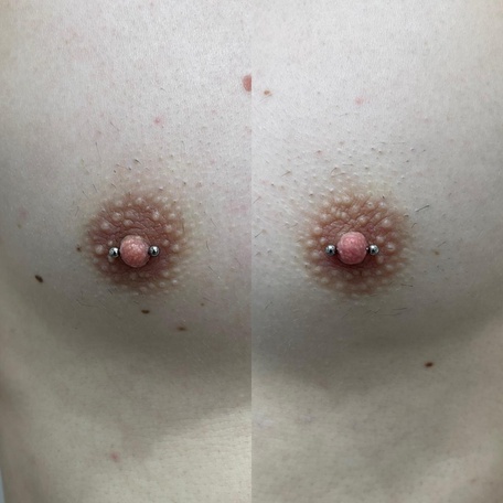 ПИРСИНГ СОСКОВ