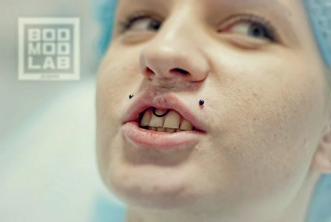 ПИРСИНГ LABRET УКУСЫ